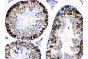 nti- Stathmin 1 Picoband antibody, IHC(P) IHC(P): Mouse Testis Tissue (Stathmin 1 抗体  (N-Term))