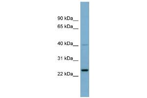 WB Suggested Anti-HSPC111 Antibody Titration: 0. (NOP16 抗体  (Middle Region))