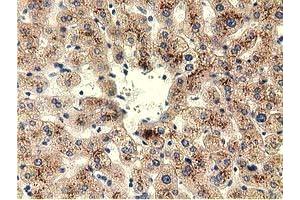 Immunohistochemical staining of paraffin-embedded Human liver tissue using anti-THOP1 mouse monoclonal antibody. (Thimet Oligopeptidase 1 抗体)