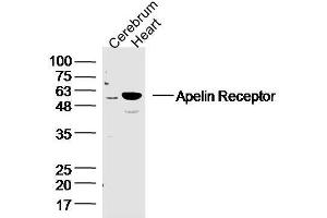 Mouse cerebrum and heart lysates probed with APJ Receptor Polyclonal Antibody, unconjugated  at 1:300 overnight at 4°C followed by a conjugated secondary antibody at 1:10000 for 90 minutes at 37°C. (Apelin Receptor 抗体  (AA 52-66))