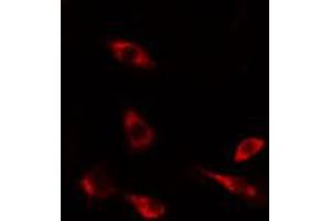 ABIN6274489 staining HeLa cells by IF/ICC. (DUSP9 抗体  (Internal Region))