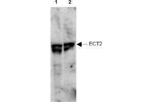 Image no. 1 for anti-Epithelial Cell Transforming Sequence 2 Oncogene (ECT2) (AA 785-795), (pThr790) antibody (ABIN401345) (ECT2 抗体  (pThr790))