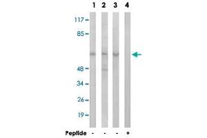 Western blot analysis of extracts from HeLa cells (Lane 1), Jurkat cells (Lane 2) and A-549 cells (Lane 3 and lane 4), using AGBL4 polyclonal antibody . (AGBL4 抗体)