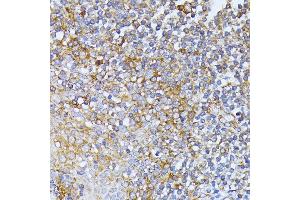 Immunohistochemistry of paraffin-embedded human tonsil using EIF2B2 antibody (ABIN6132131, ABIN6140037, ABIN6140038 and ABIN6222805) at dilution of 1:100 (40x lens). (EIF2B2 抗体  (AA 1-351))