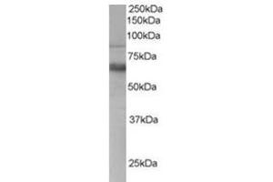 Image no. 1 for anti-anthrax Toxin Receptor 1 (ANTXR1) (C-Term) antibody (ABIN374464) (ANTXR1 抗体  (C-Term))