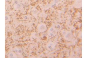Used in DAB staining on fromalin fixed paraffin-embedded Liver tissue (SIGLEC9 抗体  (AA 23-142))