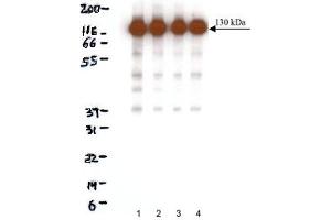 Western Blotting (WB) image for anti-Cadherin 2 (CDH2) (AA 802-819) antibody (ABIN968250) (N-Cadherin 抗体  (AA 802-819))