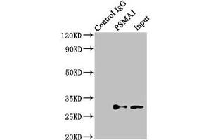 Western Blotting (WB) image for anti-Proteasome Subunit alpha Type 1 (PSMA1) (AA 163-263) antibody (ABIN7164944)