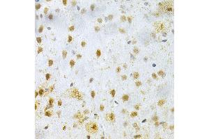 Immunohistochemistry (IHC) image for anti-Microtubule-Associated Protein 2 (MAP2) (AA 260-559) antibody (ABIN3016265)