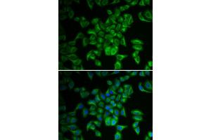 Immunofluorescence analysis of A549 cell using FXN antibody. (Frataxin 抗体)