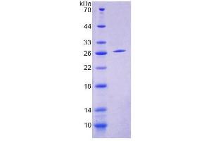 SDS-PAGE analysis of Human COVA1 Protein. (ENOX2 蛋白)