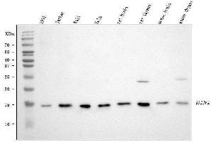 Western blot analysis of HINT1 using anti-HINT1 antibody (ABIN3042445).