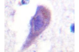Immunohistochemistry analyzes of HRS Antibody in paraffin-embedded human brain tissue. (HGS 抗体)