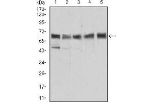 Western Blotting (WB) image for anti-Aldehyde Dehydrogenase 6 Family, Member A1 (ALDH6A1) (AA 1-195) antibody (ABIN5856297) (ALDH6A1 抗体  (AA 1-195))