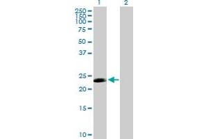 Western Blot analysis of CDC20B expression in transfected 293T cell line by CDC20B MaxPab polyclonal antibody. (CDC20B 抗体  (AA 1-192))