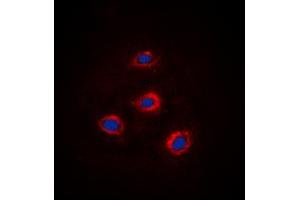 Immunofluorescent analysis of Alpha-adducin staining in HEK293 cells. (alpha Adducin 抗体  (C-Term))
