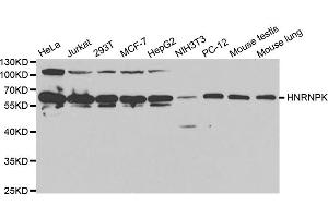 Western blot analysis of extracts of various cell lines, using HNRNPK antibody (ABIN5970850) at 1/1000 dilution. (HNRNPK 抗体)