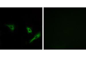 Peptide - +Immunohistochemistry analysis of paraffin-embedded human breast carcinoma tissue using ATG4A antibody. (ATG4A 抗体)