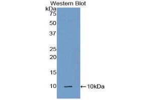 Western Blotting (WB) image for anti-Complement Component 5a (C5a) (AA 679-755) antibody (ABIN3208723) (C5A 抗体  (AA 679-755))