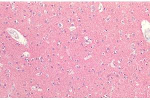 Immunohistochemistry analysis using Rabbit Anti-Tau Polyclonal Antibody (ABIN6698773). (tau 抗体  (Biotin))