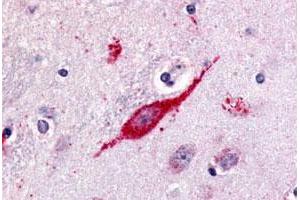 Immunohistochemical (Formalin/PFA-fixed paraffin-embedded sections) staining in human brain, neuron with GPR85 polyclonal antibody . (GPR85 抗体  (C-Term))