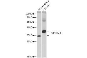 Western blot analysis of extracts of various cell lines, using ST3G antibody (ABIN6130192, ABIN6148529, ABIN6148531 and ABIN6217583) at 1:1000 dilution. (ST3GAL4 抗体  (AA 27-267))