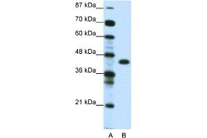 WB Suggested Anti-ZNF396 Antibody Titration:  0.
