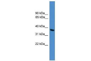 Western Blot showing UCHL5 antibody used at a concentration of 1-2 ug/ml to detect its target protein. (UCHL5 抗体  (C-Term))