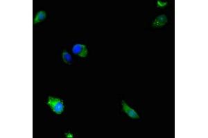 Immunofluorescence staining of Hela cells with ABIN7150717 at 1:233, counter-stained with DAPI. (MAP2K5 抗体  (AA 1-190))