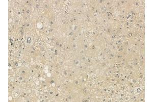 ABIN6265479 and ABIN6273328 at 1/100 staining human normal liver tissue by IHC-P. (TBC1D23 抗体  (Internal Region))