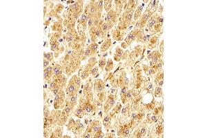 Antibody staining GAA in Human liver tissue sections by Immunohistochemistry (IHC-P - paraformaldehyde-fixed, paraffin-embedded sections). (GAA 抗体  (N-Term))