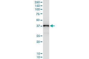 Immunoprecipitation (IP) image for anti-Glutamic-Oxaloacetic Transaminase 1, Soluble (Aspartate Aminotransferase 1) (GOT1) (AA 1-413) antibody (ABIN516133)