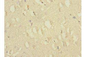 Immunohistochemistry of paraffin-embedded human brain tissue using ABIN7175576 at dilution of 1:100 (CACNG7 抗体  (AA 156-275))
