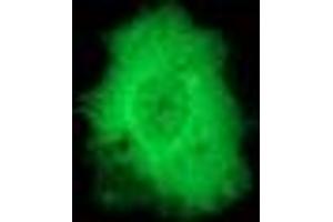 Image no. 3 for anti-Protein Phosphatase, Mg2+/Mn2+ Dependent, 1G (PPM1G) antibody (ABIN1500378) (PPM1G 抗体)