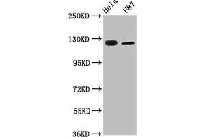 Western Blot Positive WB detected in: Hela whole cell lysate, U87 whole cell lysate All lanes: SLC4A5 antibody at 2. (NBC4 抗体  (AA 1071-1137))