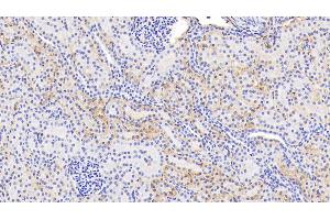 Detection of HbA1c in Human Kidney Tissue using Polyclonal Antibody to Glycated Hemoglobin A1c (HbA1c) (HbA1c 抗体)