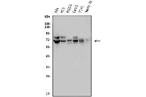 Western blot analysis of FRMD6 using anti-FRMD6 antibody (ABIN7599577). (FRMD6 抗体  (AA 1-95))