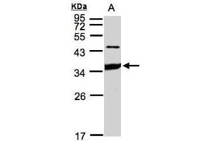 WB Image Sample(30 ug whole cell lysate) A:HeLa S3, 12% SDS PAGE antibody diluted at 1:1000 (ICAM2 抗体)