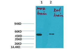Western Blot (WB) analysis of 1) Mouse Brain Tissue, 2)Rat Brain Tissue with KV1. (Kv1.1 Potassium Channel 抗体)