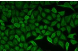 Immunofluorescence analysis of HeLa cells using CDC34 Polyclonal Antibody (CDC34 抗体)