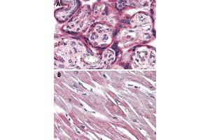 Immunohistochemical staining of formalin-fixed, paraffin-embedded human placenta (A) and human heart (B) tissue after heat-induced antigen retrieval. (EPHX2 抗体  (C-Term))