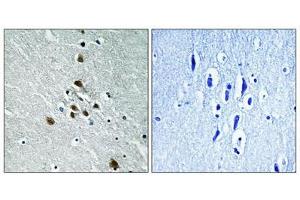 Immunohistochemical analysis of paraffin-embedded human brain tissue using SF1 (Phospho-Ser82) antibody (left)or the same antibody preincubated with blocking peptide (right). (Splicing Factor 1 抗体  (pSer82))