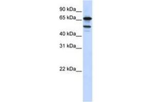 Image no. 1 for anti-Splicing Factor 4 (SF4) (AA 540-589) antibody (ABIN6740713) (Splicing Factor 4 抗体  (AA 540-589))