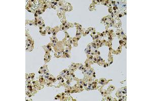 Immunohistochemistry of paraffin-embedded rat lung using CREBBP antibody (ABIN2736578) at dilution of 1:100 (40x lens). (CBP 抗体)