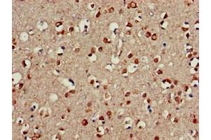 Immunohistochemistry of paraffin-embedded human brain tissue using ABIN7147214 at dilution of 1:100 (CDC42EP3 抗体  (AA 1-226))