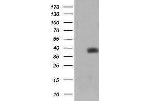 Image no. 8 for anti-Tripartite Motif Containing 44 (TRIM44) antibody (ABIN1501505)