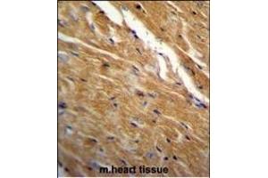 TBC1D13 Antibody (Center) (ABIN655819 and ABIN2845243) immunohistochemistry analysis in formalin fixed and paraffin embedded mouse heart tissue followed by peroxidase conjugation of the secondary antibody and DAB staining. (TBC1D13 抗体  (AA 76-105))