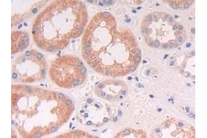 Detection of NCAM2 in Human Kidney Tissue using Polyclonal Antibody to Neural Cell Adhesion Molecule 2 (NCAM2) (NCAM2 抗体  (AA 21-297))