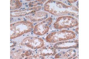 IHC-P analysis of Human Tissue, with DAB staining. (NG2 抗体  (AA 559-776))