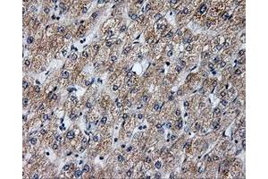 Immunohistochemical staining of paraffin-embedded liver tissue using anti-ANXA10mouse monoclonal antibody. (Annexin a10 抗体)